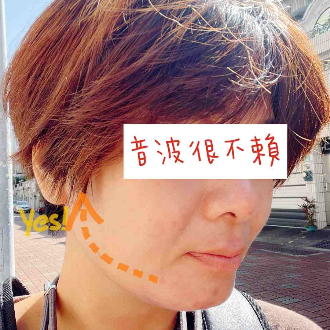 台南中正伊美音波拉提